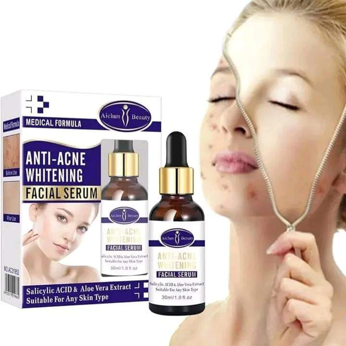 Anti-Acne Whitening Facial Serum